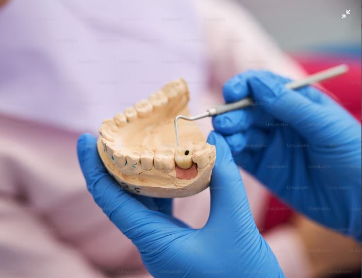 Buy Dental Plaster HighQuality USG Products General Plaster