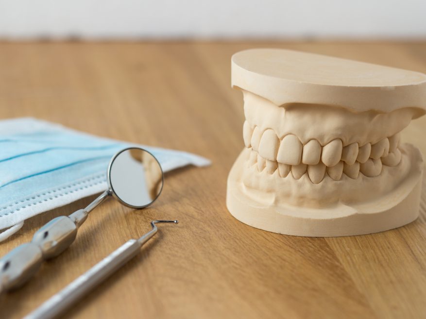 Teeth made using USG plaster and Hydrocal with dental tools